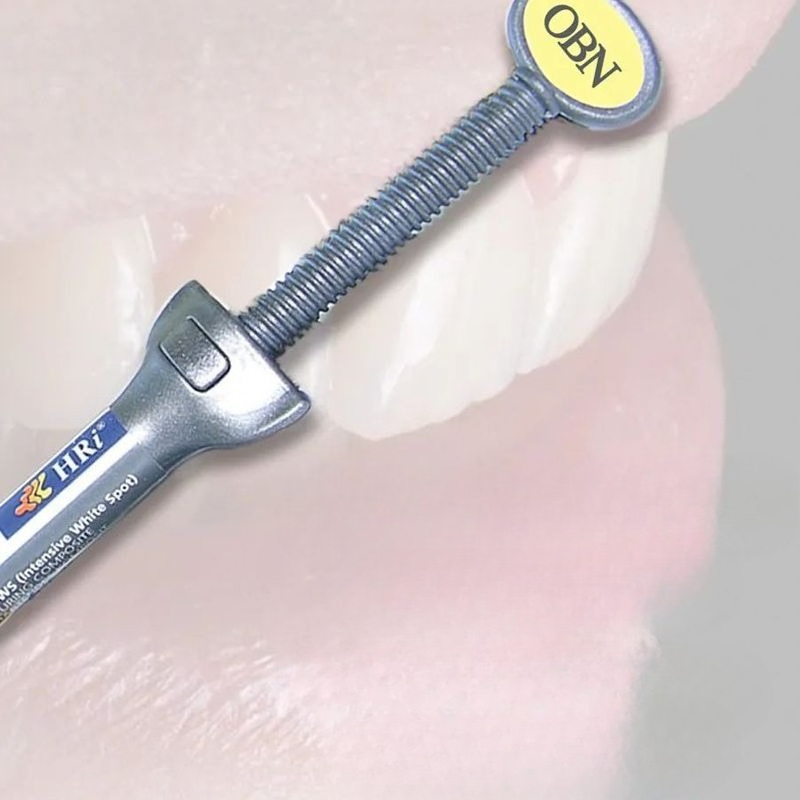 Tandheelkundige Materialen Mei - Uv Resin recensie en prijs